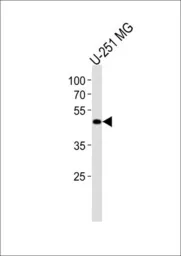 Anti-YB1 antibody, C-term used in Western Blot (WB). GTX81909