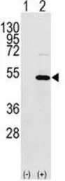 Anti-YB1 antibody, C-term used in Western Blot (WB). GTX81909