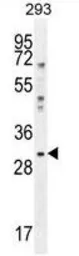 Anti-YB1 antibody, C-term used in Western Blot (WB). GTX81909