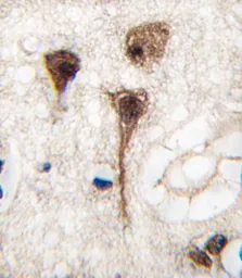 Anti-MEF2C antibody used in IHC (Paraffin sections) (IHC-P). GTX81913