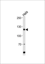 Anti-HIRA antibody, Internal used in Western Blot (WB). GTX81928