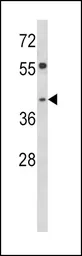 Anti-TOB2 antibody, N-term used in Western Blot (WB). GTX81931