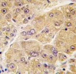 Anti-Sclerostin antibody, Internal used in IHC (Paraffin sections) (IHC-P). GTX81933