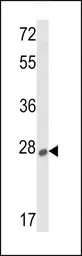 Anti-Sclerostin antibody, Internal used in Western Blot (WB). GTX81933