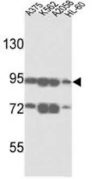 Anti-ABCB5 antibody, N-term used in Western Blot (WB). GTX81935