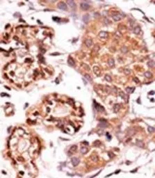 Anti-c-Abl (phospho Tyr412) antibody used in IHC (Paraffin sections) (IHC-P). GTX81938