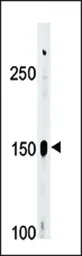 Anti-c-Abl (phospho Tyr412) antibody used in Western Blot (WB). GTX81938