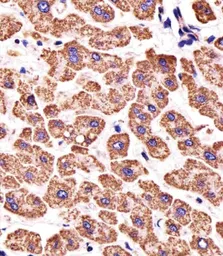 Anti-ATP5B antibody, Internal used in IHC (Paraffin sections) (IHC-P). GTX81939
