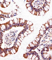 Anti-ATP5B antibody, Internal used in IHC (Paraffin sections) (IHC-P). GTX81939