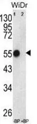 Anti-ATP5B antibody, Internal used in Western Blot (WB). GTX81939