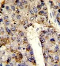 Anti-hnRNP L antibody, Internal used in IHC (Paraffin sections) (IHC-P). GTX81941