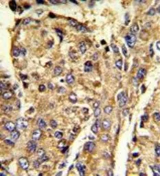 Anti-hnRNP L antibody, C-term used in IHC (Paraffin sections) (IHC-P). GTX81942