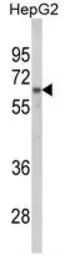 Anti-hnRNP L antibody, C-term used in Western Blot (WB). GTX81942