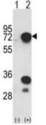 Anti-hnRNP L antibody, C-term used in Western Blot (WB). GTX81942