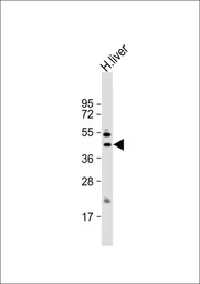 Anti-GOT1 antibody, N-term used in Western Blot (WB). GTX81944