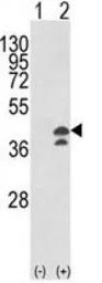 Anti-GOT1 antibody, N-term used in Western Blot (WB). GTX81944