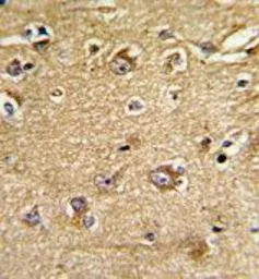 Anti-Mitofilin antibody, Internal used in IHC (Paraffin sections) (IHC-P). GTX81949