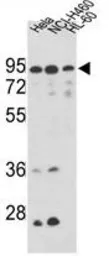 Anti-Mitofilin antibody, Internal used in Western Blot (WB). GTX81949