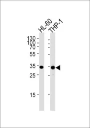 Anti-MDH1 antibody, C-term used in Western Blot (WB). GTX81955