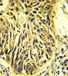 Anti-EPCR antibody, Internal used in IHC (Paraffin sections) (IHC-P). GTX81959