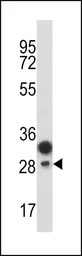 Anti-EPCR antibody, Internal used in Western Blot (WB). GTX81959