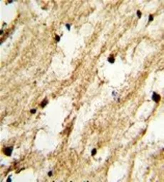 Anti-DCC1 antibody, N-term used in IHC (Paraffin sections) (IHC-P). GTX81965