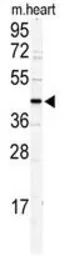 Anti-DCC1 antibody, N-term used in Western Blot (WB). GTX81965