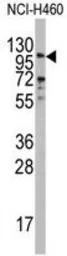 Anti-Exonuclease 1 antibody, N-term used in Western Blot (WB). GTX81967
