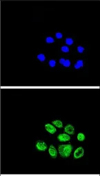 Anti-Exonuclease 1 antibody, N-term used in Immunocytochemistry/ Immunofluorescence (ICC/IF). GTX81967