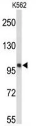 Anti-HSP105 antibody, Internal used in Western Blot (WB). GTX81974