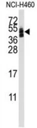 Anti-Coxsackie Adenovirus Receptor antibody, Internal used in Western Blot (WB). GTX81978