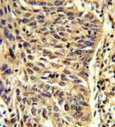 Anti-SNRPD1 antibody, Internal used in IHC (Paraffin sections) (IHC-P). GTX81985