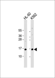 Anti-SNRPD1 antibody, Internal used in Western Blot (WB). GTX81985