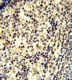 Anti-SNRPD1 antibody, C-term used in IHC (Paraffin sections) (IHC-P). GTX81986