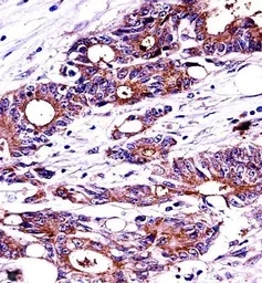 Anti-Nucleophosmin antibody, C-term used in IHC (Paraffin sections) (IHC-P). GTX81995