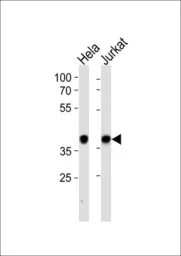 Anti-Nucleophosmin antibody, C-term used in Western Blot (WB). GTX81995