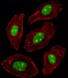 Anti-Nucleophosmin antibody, C-term used in Immunocytochemistry/ Immunofluorescence (ICC/IF). GTX81995
