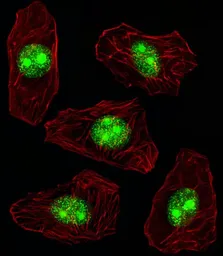 Anti-Nucleophosmin antibody, N-term used in Immunocytochemistry/ Immunofluorescence (ICC/IF). GTX81996