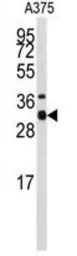 Anti-Syntaxin 3 antibody, Internal used in Western Blot (WB). GTX82488