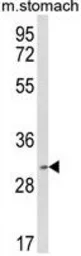 Anti-SC35 antibody, Internal used in Western Blot (WB). GTX82500