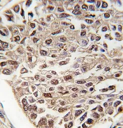 Anti-SC35 antibody, N-term used in IHC (Paraffin sections) (IHC-P). GTX82501
