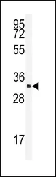 Anti-SC35 antibody, N-term used in Western Blot (WB). GTX82501