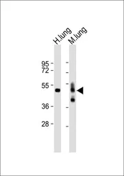 Anti-RAGE antibody, N-term used in Western Blot (WB). GTX82505