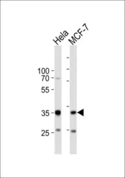 Anti-SNAI1 antibody, N-term used in Western Blot (WB). GTX82509