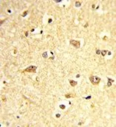 Anti-SOX4 antibody, Internal used in IHC (Paraffin sections) (IHC-P). GTX82512