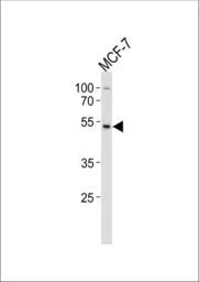 Anti-SOX4 antibody, Internal used in Western Blot (WB). GTX82512