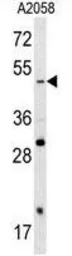 Anti-SOX4 antibody, N-term used in Western Blot (WB). GTX82513