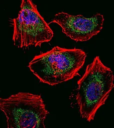 Anti-SOX4 antibody, N-term used in Immunocytochemistry/ Immunofluorescence (ICC/IF). GTX82513
