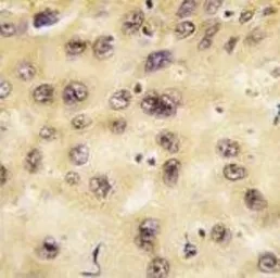 Anti-PROX1 antibody, Internal used in IHC (Paraffin sections) (IHC-P). GTX82515