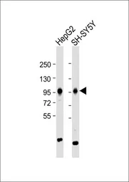 Anti-PROX1 antibody, Internal used in Western Blot (WB). GTX82515